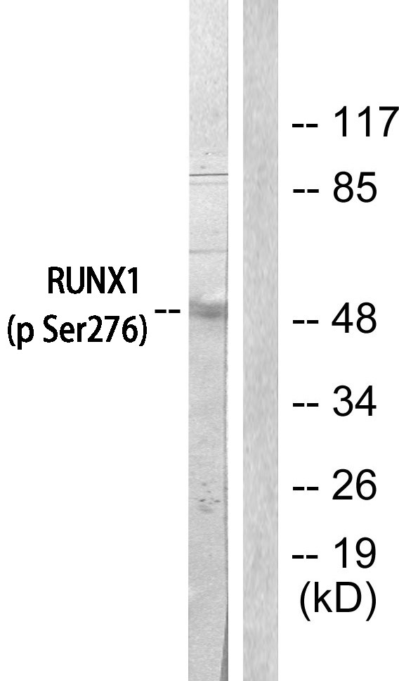  Western blot analysis of lysates from Jurkat cells, using AML1 (Phospho-Ser303) Antibody. The lane on the right is blocked with the phospho peptide.