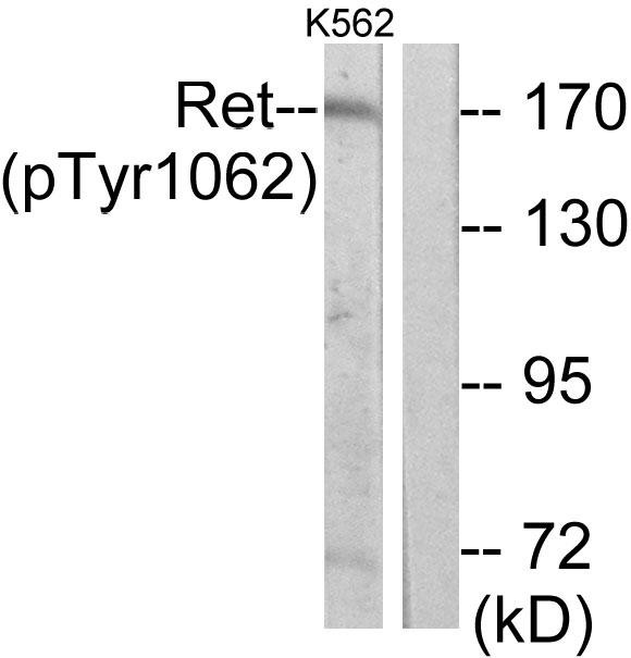 Ret (phospho Tyr1062) Polyclonal Antibody