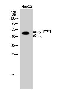 PTEN (Acetyl Lys402) Polyclonal Antibody