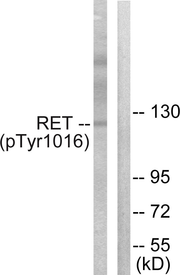 Ret (phospho Tyr1015) Polyclonal Antibody