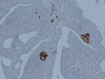Synaptophysin (2D2) Monoclonal Antibody