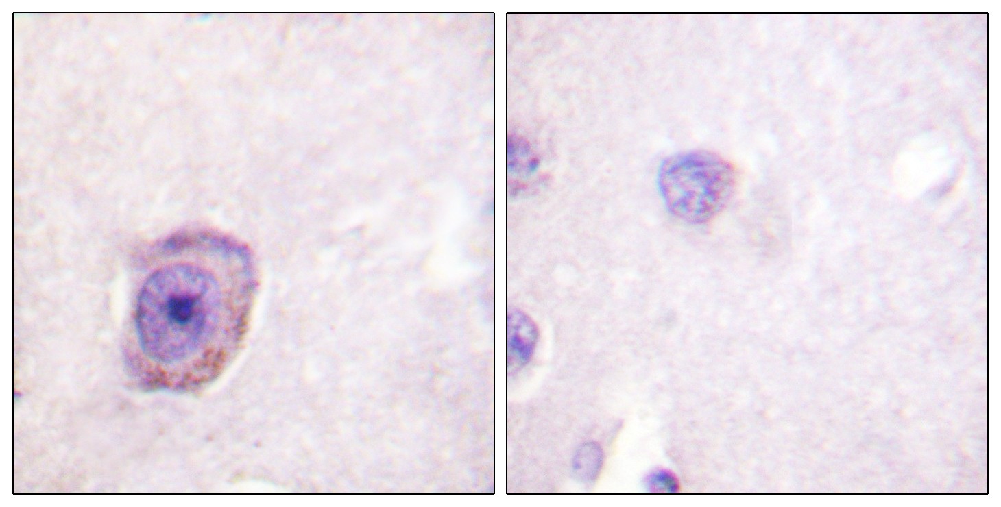  Immunohistochemistry analysis of paraffin-embedded human brain, using Rhodopsin (Phospho-Ser334) Antibody. The picture on the right is blocked with the phospho peptide.