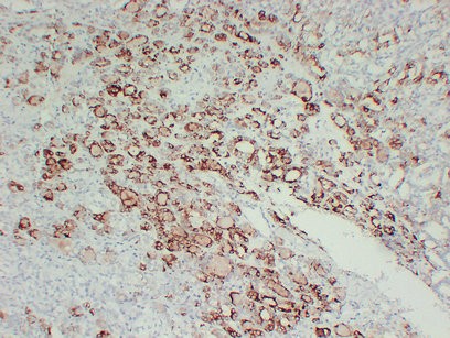 TPO (2G2) mouse Monoclonal Antibody
