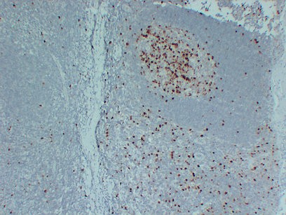 Topoisomerase IIa, CONFIRM Monoclonal Antibody (PT0247)