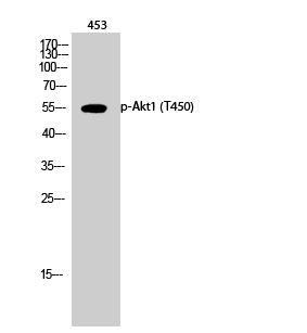  Western Blot analysis of 453 cells using Phospho-Akt1 (T450) Polyclonal Antibody diluted at 1：1000