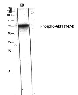  Western Blot analysis of KB using Phospho-Akt1 (Y474) Polyclonal Antibody diluted at 1：1000