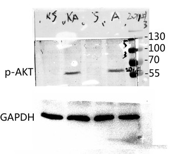  Western blot analysis of various lysis using Phospho-Akt1 (T450) Polyclonal Antibody diluted at 1：1000. Secondary antibody(catalog#：RS0002) was diluted at 1:20000