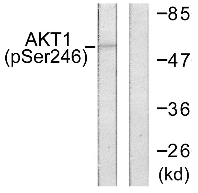  Western blot analysis of lysates from HeLa cells treated with Etoposide 25uM 24h, using Akt (Phospho-Ser246) Antibody. The lane on the right is blocked with the phospho peptide.