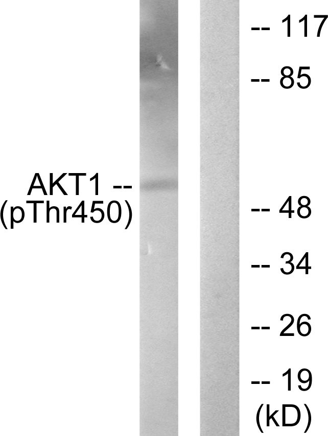  Western blot analysis of lysates from NIH/3T3 cells treated with PDGF 50ng/ml 20', using Akt1 (Phospho-Thr450) Antibody. The lane on the right is blocked with the phospho peptide.