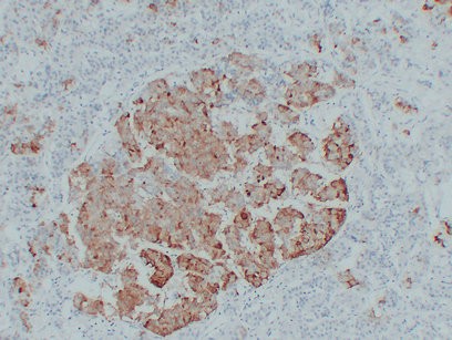 TSH Monoclonal Antibody (PT0249)