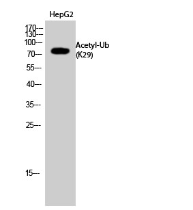 Ub (Acetyl Lys29) Polyclonal Antibody