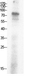  Western Blot analysis of HepG2 cells using Acetyl-Ub (K29) Polyclonal Antibody.. Secondary antibody(catalog#：RS0002) was diluted at 1:20000