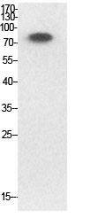  Western Blot analysis of HeLa cells using Acetyl-Ub (K33) Polyclonal Antibody.. Secondary antibody(catalog#：RS0002) was diluted at 1:20000