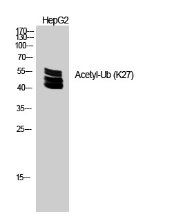  Western Blot analysis of HEPG2 cells using Acetyl-Ub (K27) Polyclonal Antibody. Secondary antibody(catalog#：RS0002) was diluted at 1:20000