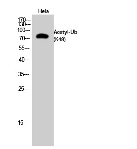 Ub (Acetyl Lys48) Polyclonal Antibody