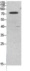  Western Blot analysis of HeLa cells using Acetyl-Ub (K48) Polyclonal Antibody.. Secondary antibody(catalog#：RS0002) was diluted at 1:20000