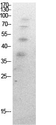  Western Blot analysis of HeLa cells using Acetyl-Ub (K27) Polyclonal Antibody.. Secondary antibody(catalog#：RS0002) was diluted at 1:20000