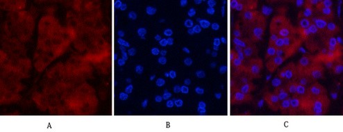  Immunofluorescence analysis of Human-stomach-cancer tissue. 1,Ubiquitin Mouse Monoclonal Antibody(5F1)(red) was diluted at 1:200(4°C,overnight). 2, Cy3 labled Secondary antibody was diluted at 1:300(room temperature, 50min).3, Picture B: DAPI(blue) 10min. Picture A:Target. Picture B: DAPI. Picture C: merge of A+B