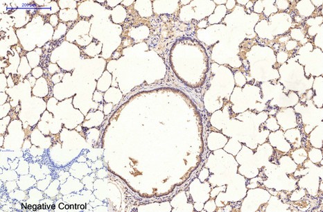  Immunohistochemical analysis of paraffin-embedded Rat-lung tissue. 1,Ubiquitin Mouse Monoclonal Antibody(5F1) was diluted at 1:200(4°C,overnight). 2, Sodium citrate pH 6.0 was used for antibody retrieval(>98°C,20min). 3,Secondary antibody was diluted at 1:200(room tempeRature, 30min). Negative control was used by secondary antibody only.
