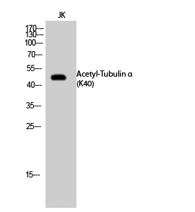  Western Blot analysis of JK cells using Acetyl-Tubulin α (K40) Polyclonal Antibody. Secondary antibody(catalog#：RS0002) was diluted at 1:20000