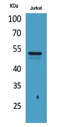  Western Blot analysis of Jurkat cells using Acetyl-Tubulin α (K40) Polyclonal Antibody.. Secondary antibody(catalog#：RS0002) was diluted at 1:20000