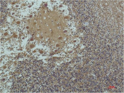  Immunohistochemical analysis of paraffin-embedded Human Brain Tissue using a-tubulin(Acetyl Lys40) Mouse mAb diluted at 1:200.