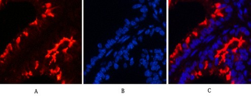  Immunofluorescence analysis of Mouse-lung tissue. 1,α-tubulin (Acetyl Lys40) Monoclonal Antibody(4A8)(red) was diluted at 1:200(4°C,overnight). 2, Cy3 labled Secondary antibody was diluted at 1:300(room temperature, 50min).3, Picture B: DAPI(blue) 10min. Picture A:Target. Picture B: DAPI. Picture C: merge of A+B