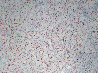 WT1 Mouse Monoclonal Antibody(PT0264)
