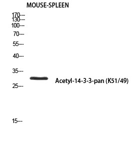 14-3-3-pan (Acetyl Lys51/49) Polyclonal Antibody