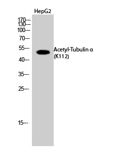 α-Tubulin (Acetyl Lys112) Polyclonal Antibody