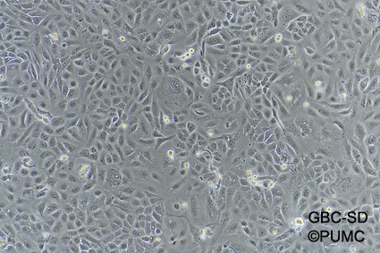 GBC-SD	人膽囊癌細胞