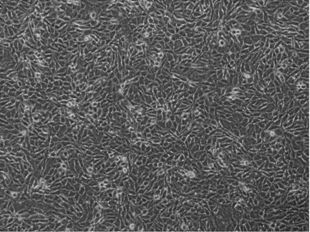 ES-2	人卵巢透明细胞癌细胞
