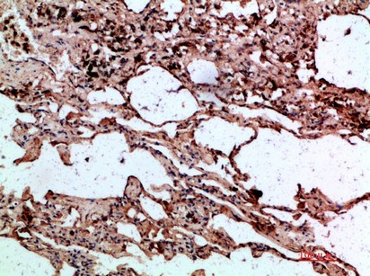  Immunohistochemical analysis of paraffin-embedded human-lung, antibody was diluted at 1:200