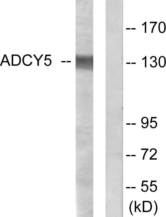  Western blot analysis of lysates from COLO205 cells, using ADCY5/6 Antibody. The lane on the right is blocked with the synthesized peptide.
