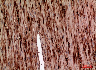  Immunohistochemical analysis of paraffin-embedded human-colon, antibody was diluted at 1:100