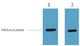   HA fusion protein+ Primary antibody dilution at 1) 1:5000 2) 1:20000. Secondary antibody(catalog#：RS0002) was diluted at 1:20000